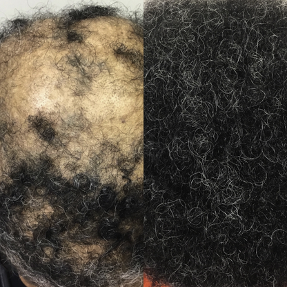 Root Revive Capsules