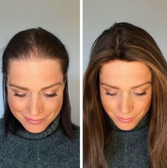 Hair Growth Accelerator - with Lustriva®