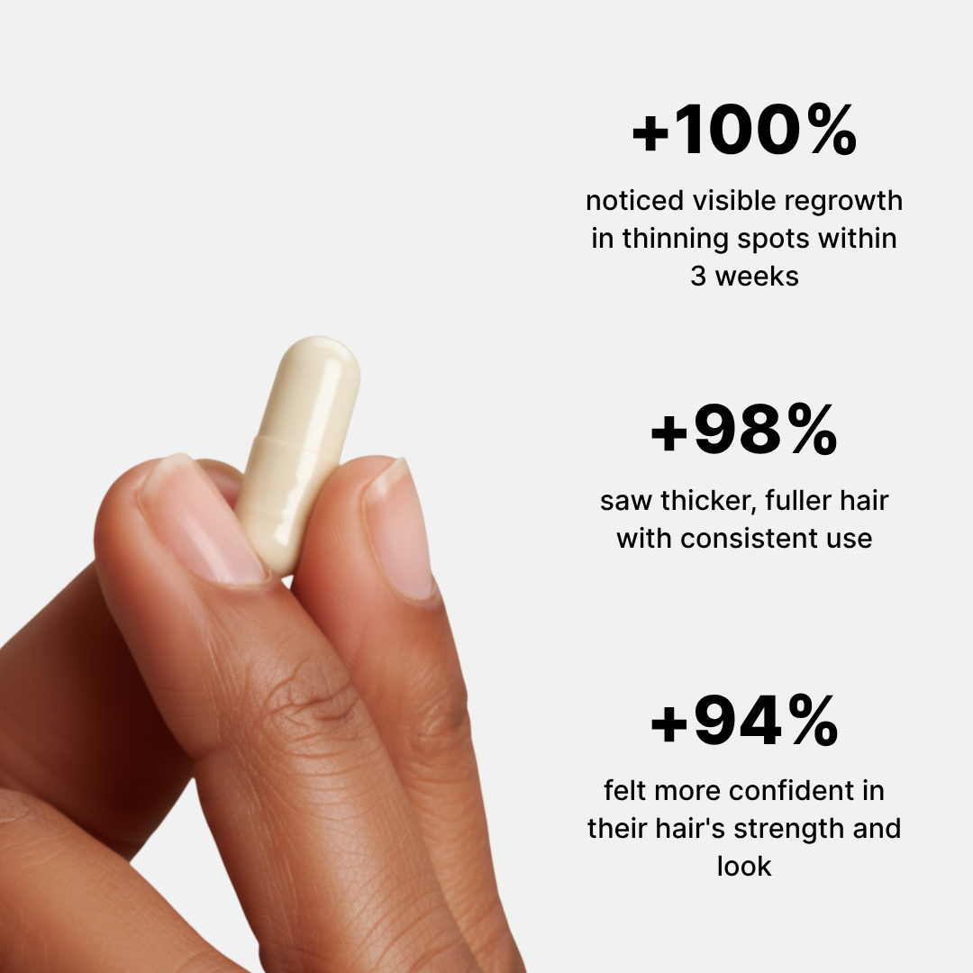 Root Revive - Edge Growth Capsules pq3