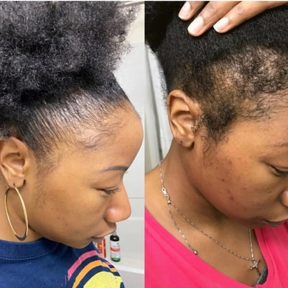 Root Revive Capsules