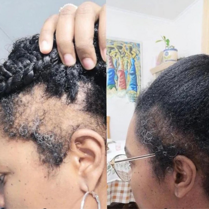 Root Revive - Edge & Hair Growth Capsules