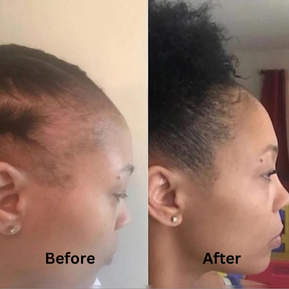 Root Revive - Edge & Hair Growth Capsules