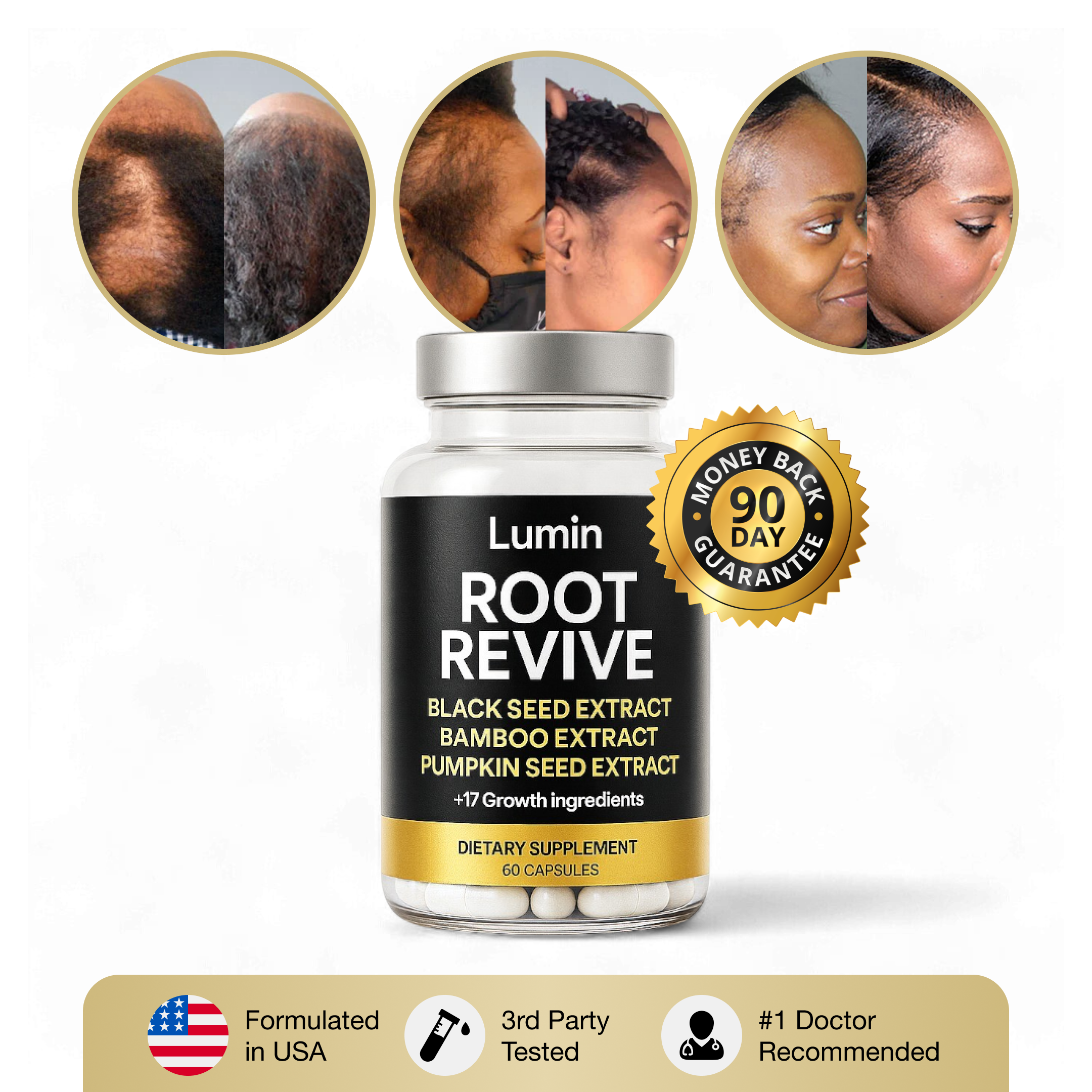 "My Bald Spots Are Gone, Edges are Growing Back & I Finally Feel Beautiful Again!"